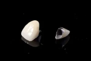 メタルボンド