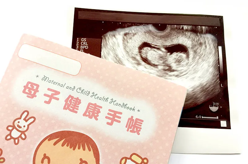 妊娠中と歯周病の関係