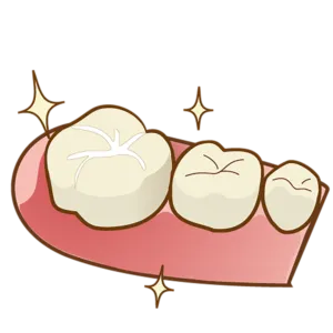 シーラント